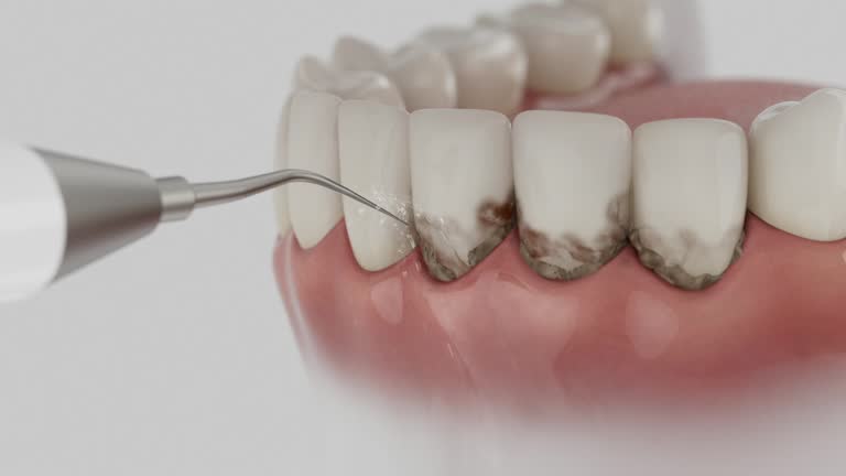 Reliable Teeth Cleaning And Checkup contractor in Chatham County County, NC by Dentist Open Now
